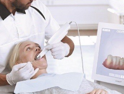 prijs voor intra-orale scanner