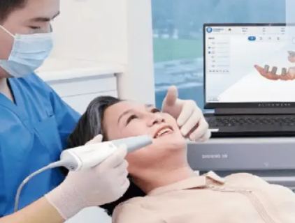 Orale scanner toepassen