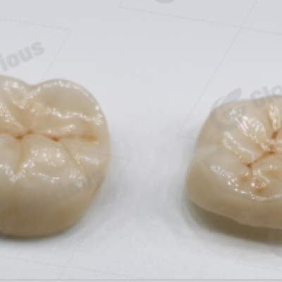 3D zirconia