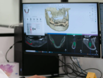 치과용 CAD/CAM 기술