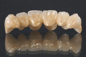 Ceramic Dental Crowns