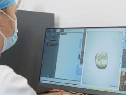 CAD-CAM
