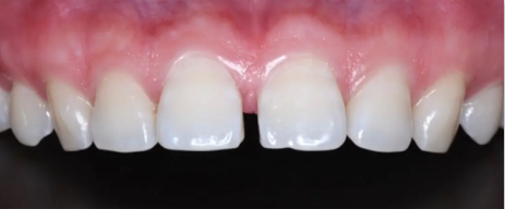 1699346690448814.png 1699346690448814.png